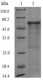 Greater than 90% as determined by SDS-PAGE.Recombinant Mouse 60S Acidic Ribosomal Protein P0 (RPLP0) Protein (His-SUMO&Myc)