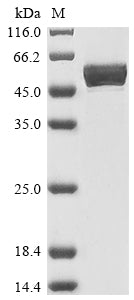 Greater than 90% as determined by SDS-PAGE.Recombinant Human 40S Ribosomal Protein S6 (RPS6) Protein (His-GST)