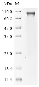 Greater than 85% as determined by SDS-PAGE.Recombinant Mouse Ribosomal Protein S6 Kinase Alpha-4 (RPS6KA4) Protein (His)
