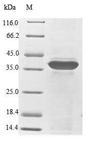 Greater than 85% as determined by SDS-PAGE.