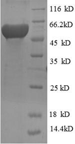 Greater than 90% as determined by SDS-PAGE.Recombinant Human Ribonucleoside-Diphosphate Reductase Subunit M2 (RRM2) Protein (His-SUMO)