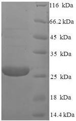 Greater than 90% as determined by SDS-PAGE.Recombinant Human Retinoschisin (RS1) Protein (His)