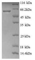 Greater than 90% as determined by SDS-PAGE.Recombinant Human Ryanodine Receptor 1 (RYR1) Protein (His)
