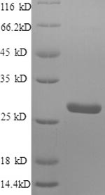 Greater than 90% as determined by SDS-PAGE.Recombinant Human Protein S100-A4 (S100A4) Protein (His-SUMO)