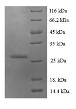Greater than 90% as determined by SDS-PAGE.