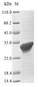 Greater than 85% as determined by SDS-PAGE.Recombinant Bovine Serum Amyloid A Protein (SAA1) Protein (His-SUMO&Myc)