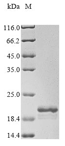Greater than 85% as determined by SDS-PAGE.Recombinant Bovine Serum Amyloid A Protein (SAA1) Protein (His)