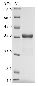 Greater than 90% as determined by SDS-PAGE.Recombinant Human Uteroglobin (SCGB1A1) Protein (His-GST)