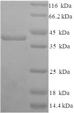 Greater than 90% as determined by SDS-PAGE.Recombinant Human Syndecan-1 (SDC1) Protein (His-SUMO)