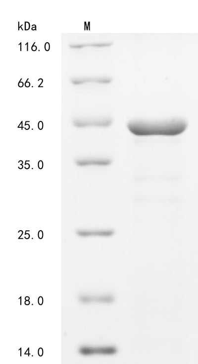 Greater than 85% as determined by SDS-PAGE.Recombinant Human Syntenin-1 (SDCBP) Protein (His-KSI)