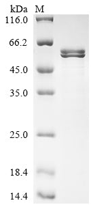 Greater than 85% as determined by SDS-PAGE.Recombinant Human Semenogelin-1 (SEMG1) Protein (His)