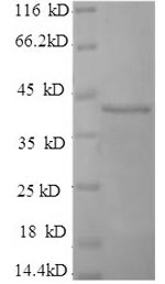 Greater than 90% as determined by SDS-PAGE.Recombinant Human Selenoprotein P (SELENOP) Protein (His)