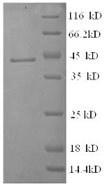 Greater than 90% as determined by SDS-PAGE.Recombinant Human Corticosteroid-Binding Globulin (SERPINA6) Protein (GST)