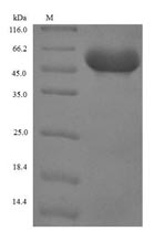 Greater than 90% as determined by SDS-PAGE.Recombinant Human Serpin B4 (SERPINB4) Protein (His-SUMO)