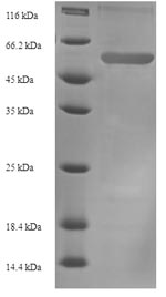 Greater than 90% as determined by SDS-PAGE.Recombinant Mouse Plasminogen Activator Inhibitor 1 (SERPINE1) Protein (His-SUMO)