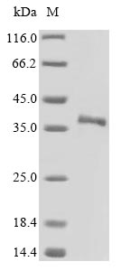 Greater than 85% as determined by SDS-PAGE.Recombinant Mouse Secreted Frizzled-Related Protein 5 (SFRP5) Protein (His)