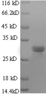 Greater than 90% as determined by SDS-PAGE.