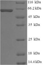 Greater than 90% as determined by SDS-PAGE.Recombinant Human Melanocyte Protein Pmel (PMEL) Protein (His-SUMO)