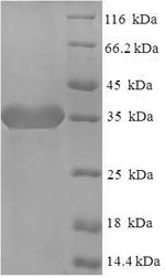 Greater than 90% as determined by SDS-PAGE.