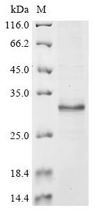 Greater than 85% as determined by SDS-PAGE.Recombinant Human Reduced Folate Transporter (SLC19A1) Protein (His&Myc)