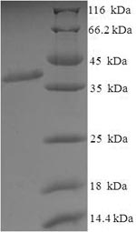 Greater than 90% as determined by SDS-PAGE.