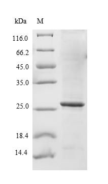 Greater than 85% as determined by SDS-PAGE.Recombinant Human Sodium-Dependent Phosphate Transport Protein 2B (SLC34A2) Protein (His-B2M)