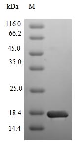 Greater than 90% as determined by SDS-PAGE.Recombinant Human Sodium/Glucose Cotransporter 2 (SLC5A2) Protein (His&Myc)
