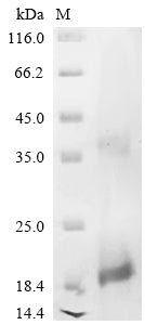 Greater than 90% as determined by SDS-PAGE.Recombinant Human Slit Homolog 3 Protein (SLIT3) Protein (His)