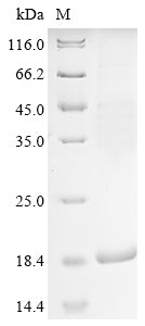 Greater than 85% as determined by SDS-PAGE.Recombinant Human Sarcolipin (SLN) Protein (His-KSI)