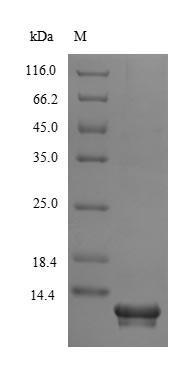 Greater than 85% as determined by SDS-PAGE.Recombinant Human Secreted Ly-6/Upar-Related Protein 1 (SLURP1)