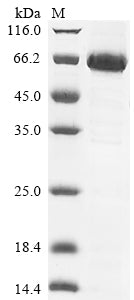 Greater than 85% as determined by SDS-PAGE.Recombinant Human Mothers Against Decapentaplegic Homolog 6 (SMAD6) Protein (His&Myc)