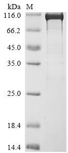Greater than 90% as determined by SDS-PAGE.Biotinylated Recombinant Human Probable Global Transcription Activator Snf2L2 (SMARCA2) Protein (MBP&His-Avi)