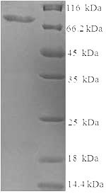 Greater than 90% as determined by SDS-PAGE.Recombinant Human Probable Global Transcription Activator Snf2L2 (SMARCA2) Protein (His-SUMO)