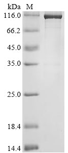 Greater than 90% as determined by SDS-PAGE.Biotinylated Recombinant Human Transcription Activator Brg1 (SMARCA4) Protein (MBP&His-Avi)