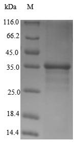 Greater than 90% as determined by SDS-PAGE.Recombinant Human Transcription Activator Brg1 (SMARCA4) Protein (His)