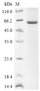 Greater than 85% as determined by SDS-PAGE.Recombinant Human Sphingomyelin Phosphodiesterase (SMPD1) Protein (His)