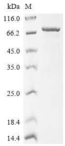 Greater than 90% as determined by SDS-PAGE.Recombinant Human Sphingomyelin Phosphodiesterase (SMPD1) Protein (His-SUMO)