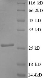 Greater than 90% as determined by SDS-PAGE.Recombinant Human Synaptosomal-Associated Protein 25 (SNAP25) Protein (His)