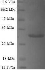 Greater than 90% as determined by SDS-PAGE.