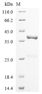 Greater than 85% as determined by SDS-PAGE.Recombinant Human U1 Small Nuclear Ribonucleoprotein A (SNRPA) Protein (His&Myc)