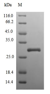 Greater than 90% as determined by SDS-PAGE.Recombinant Human Extracellular Superoxide Dismutase [Cu-Zn] (SOD3) Protein (His)