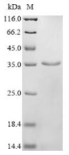 Greater than 85% as determined by SDS-PAGE.Recombinant Human Sorbin And Sh3 Domain-Containing Protein 2 (SORBS2) Protein (His)