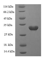 Greater than 90% as determined by SDS-PAGE.Recombinant Rat Sortilin (SORT1) Protein (His-SUMO)