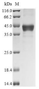 Greater than 85% as determined by SDS-PAGE.Recombinant Human Transcription factor SOX-2 (SOX2) Protein (His)