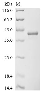 Greater than 90% as determined by SDS-PAGE.Recombinant Human Transcription Factor Sox-2 (SOX2) Protein (His)