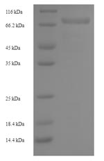 Greater than 90% as determined by SDS-PAGE.Recombinant Human Hyaluronidase Ph-20 (SPAM1) Protein (His-SUMO)