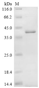 Greater than 85% as determined by SDS-PAGE.Recombinant Human Leukosialin (SPN) Protein (His)