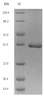 Greater than 90% as determined by SDS-PAGE.Recombinant Human Small Proline-Rich Protein 3 (SPRR3) Protein (His-SUMO)