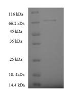 Greater than 90% as determined by SDS-PAGE.Recombinant Human Serine Palmitoyltransferase 2 (SPTLC2) Protein (His-SUMO)