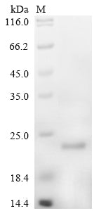 Greater than 90% as determined by SDS-PAGE.Recombinant Mouse Serglycin (SRGN) Protein (His)